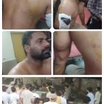 पालिका लाईनमैन को बुरी तरह पीटा, मारपीट का वीडियो वायरल